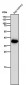 Anti-AKR1C3 Rabbit Monoclonal Antibody